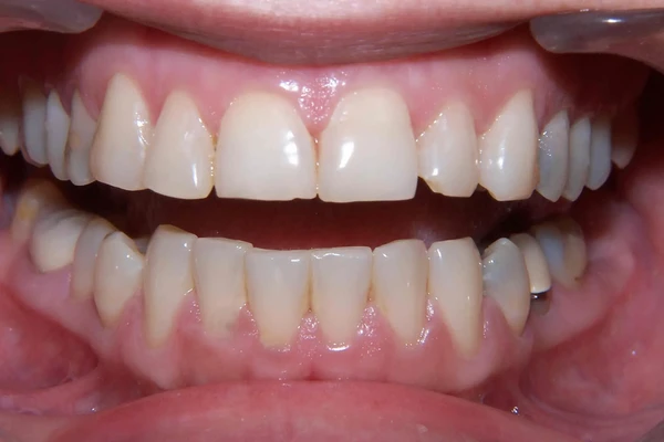 Before smile photo 3