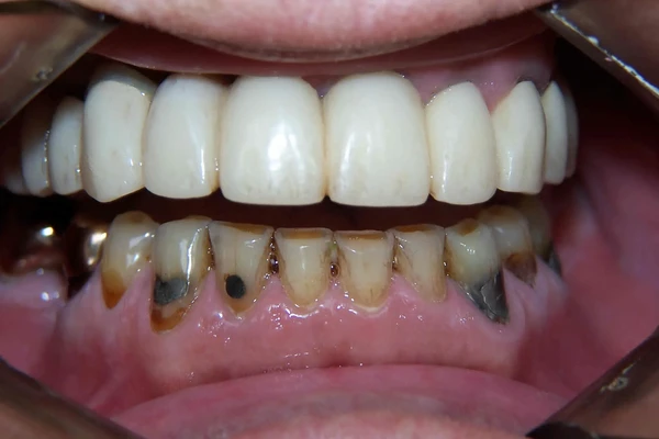 Before smile photo 1